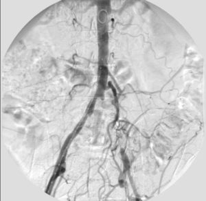 Arteriografia diagnóstica
